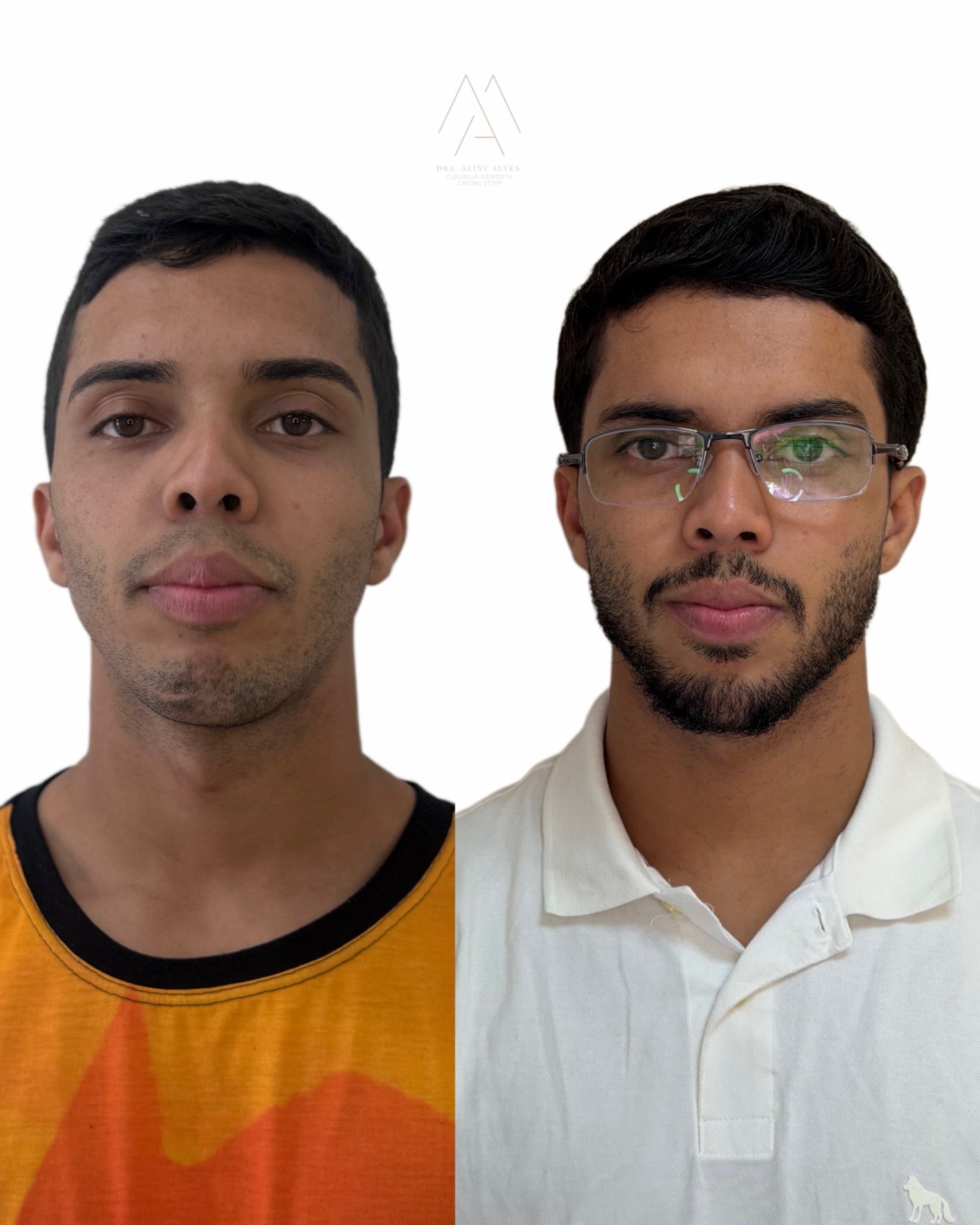 Full face masculino