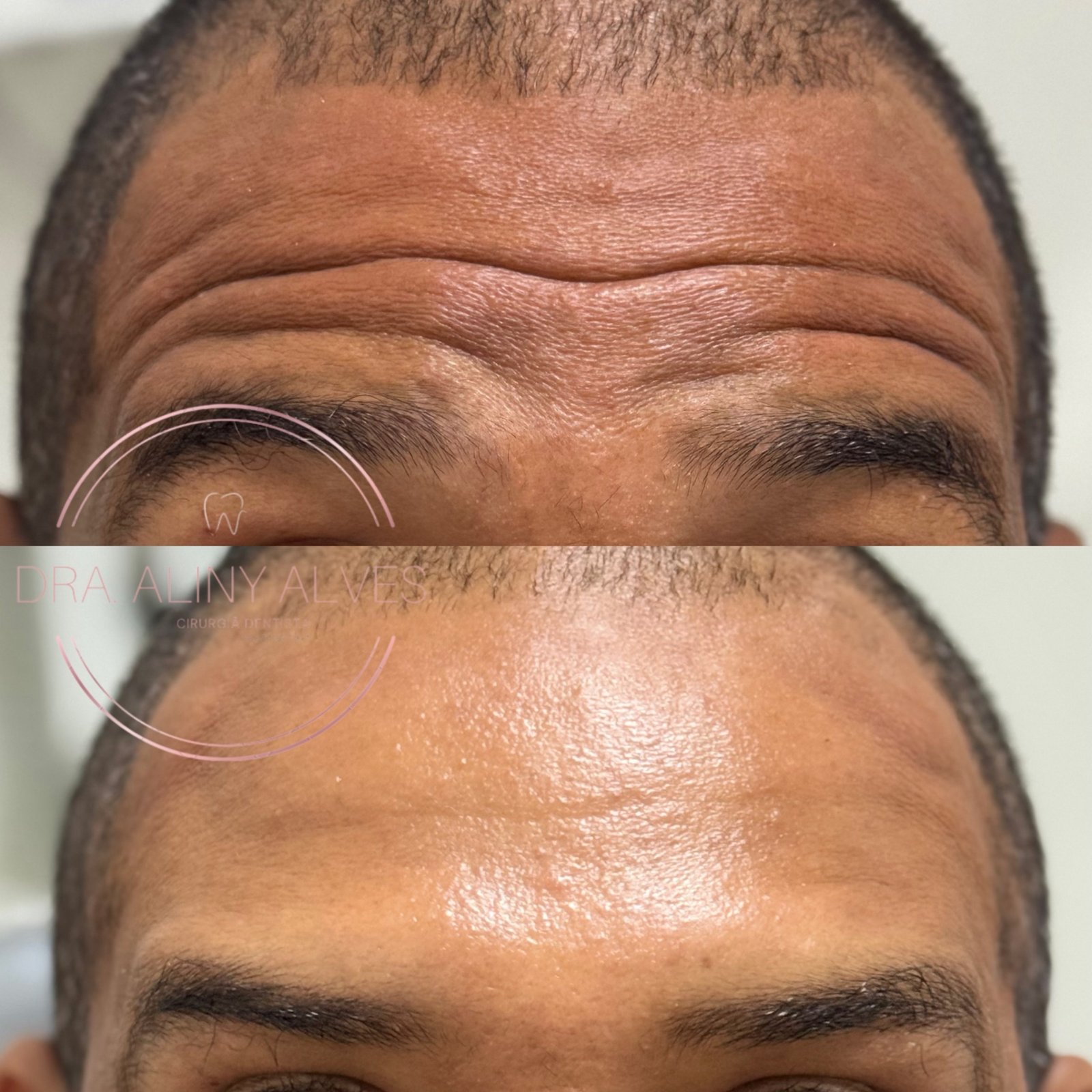 Foto do trabalho de Doutora Aliny Alves — Dentista